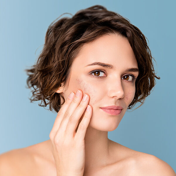 WHAT IS UNEVEN SKIN TONE AND HOW TO HELP MANAGE IT