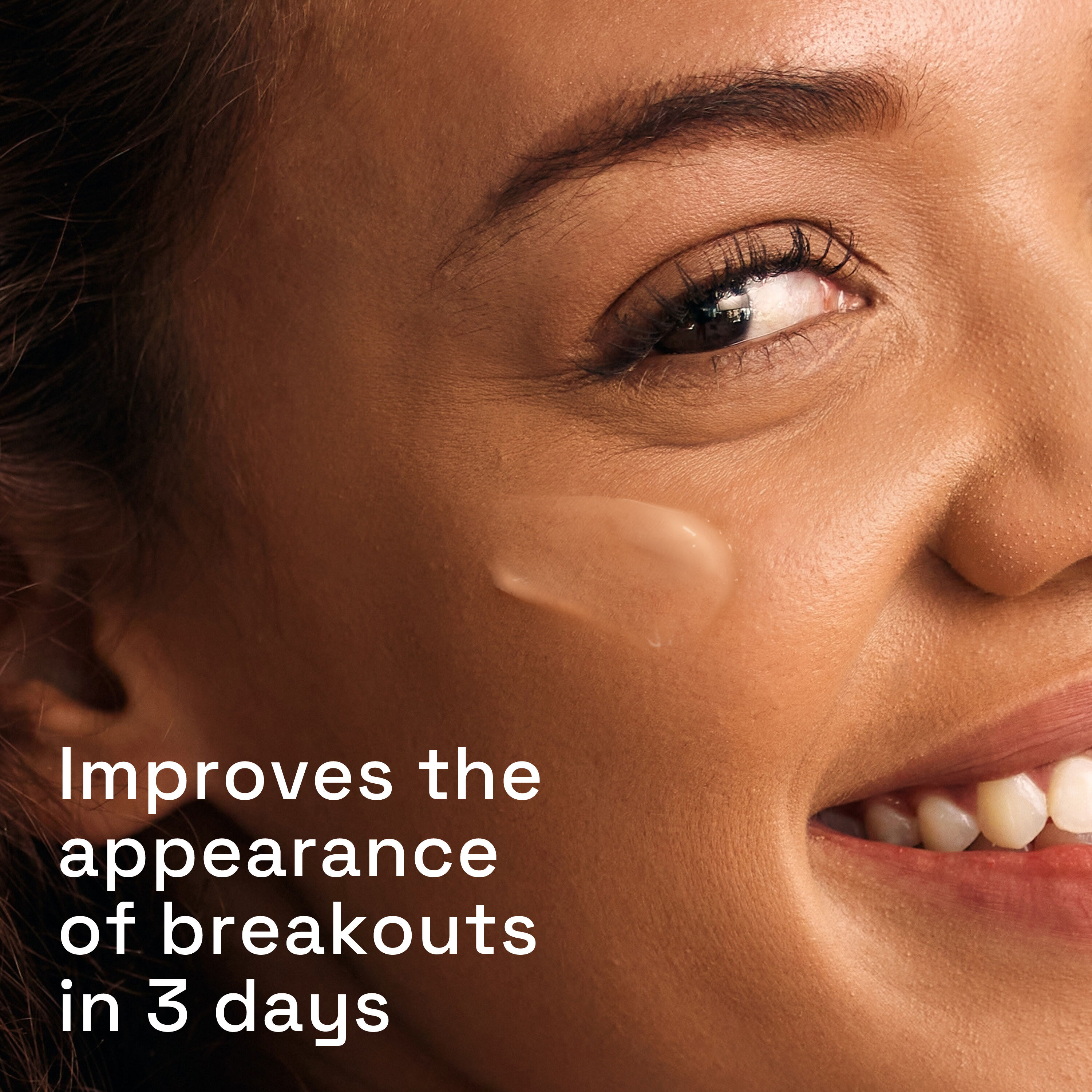 Gentle Clear Triple Action Blemish Serum