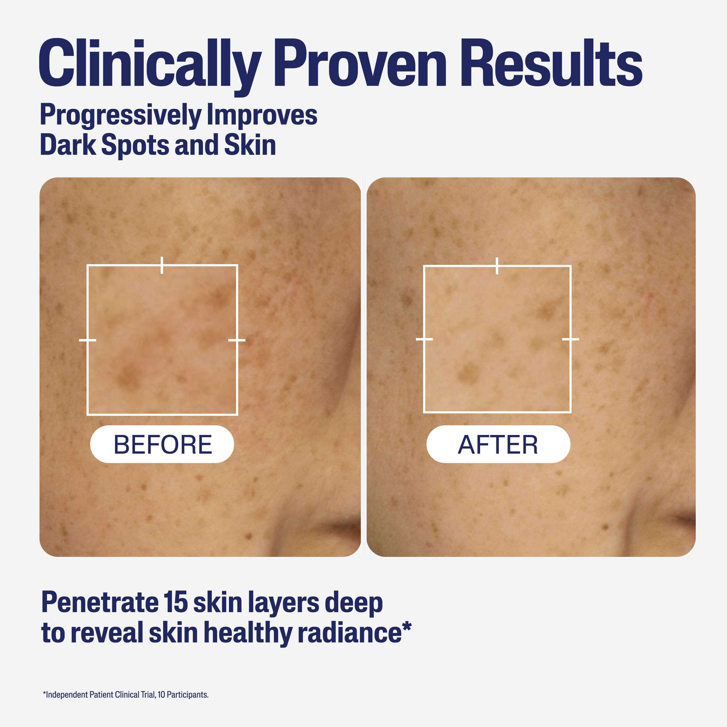 Healthy Radiance Brightening Serum