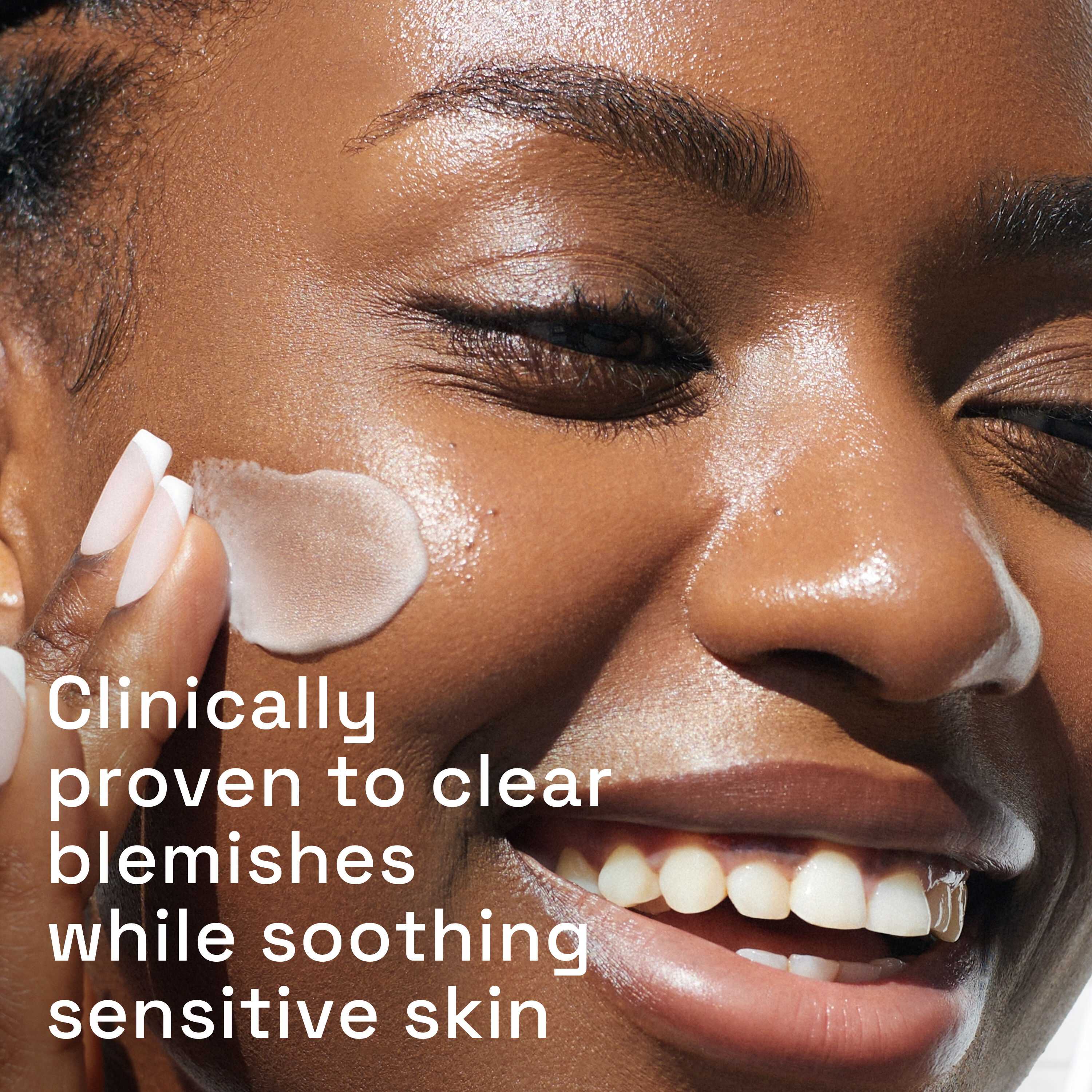Gentle Clear Mattifying Blemish Moisturiser